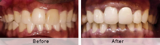 Smile Gallery