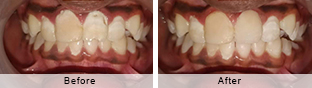 Smile Gallery