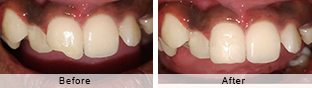 Smile Gallery