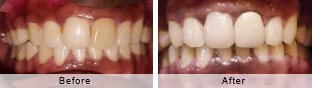 Smile Gallery