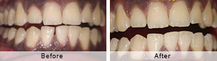 Smile Gallery