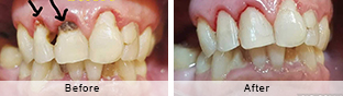 Smile Gallery